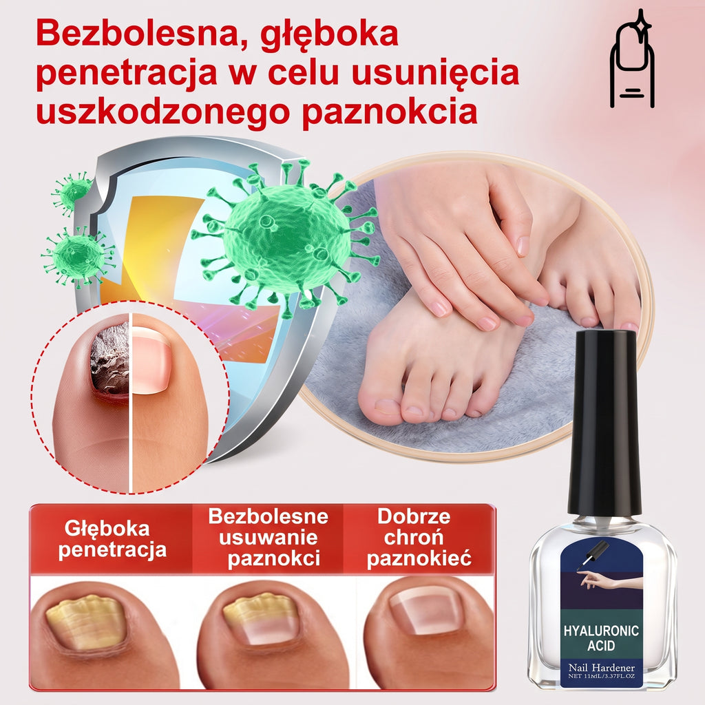 Ziołowe Serum do Regeneracji Paznokci – Skuteczny Preparat na Grzybicę i Odbudowę Płytki (Z Kwasem Hialuronowym)