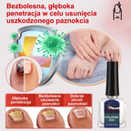 Ziołowe Serum do Regeneracji Paznokci – Skuteczny Preparat na Grzybicę i Odbudowę Płytki (Z Kwasem Hialuronowym)
