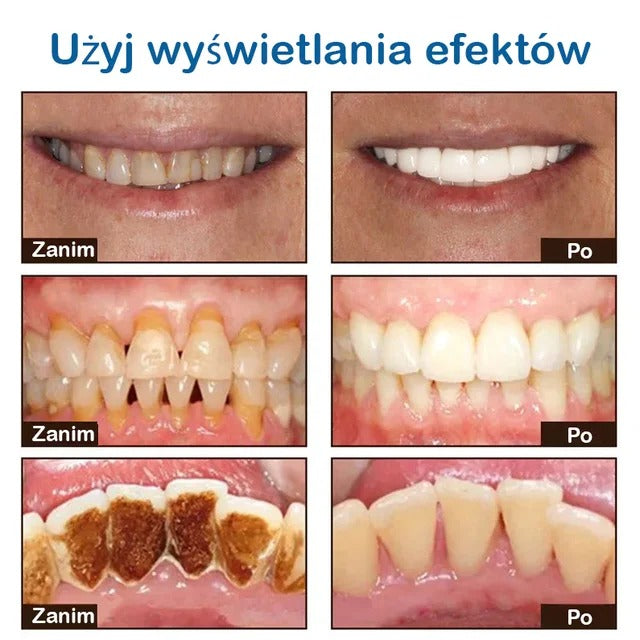 Wybielająca Pasta do Zębów z Niacynamidem – Usuwanie Przebarwień i Świeży Oddech
