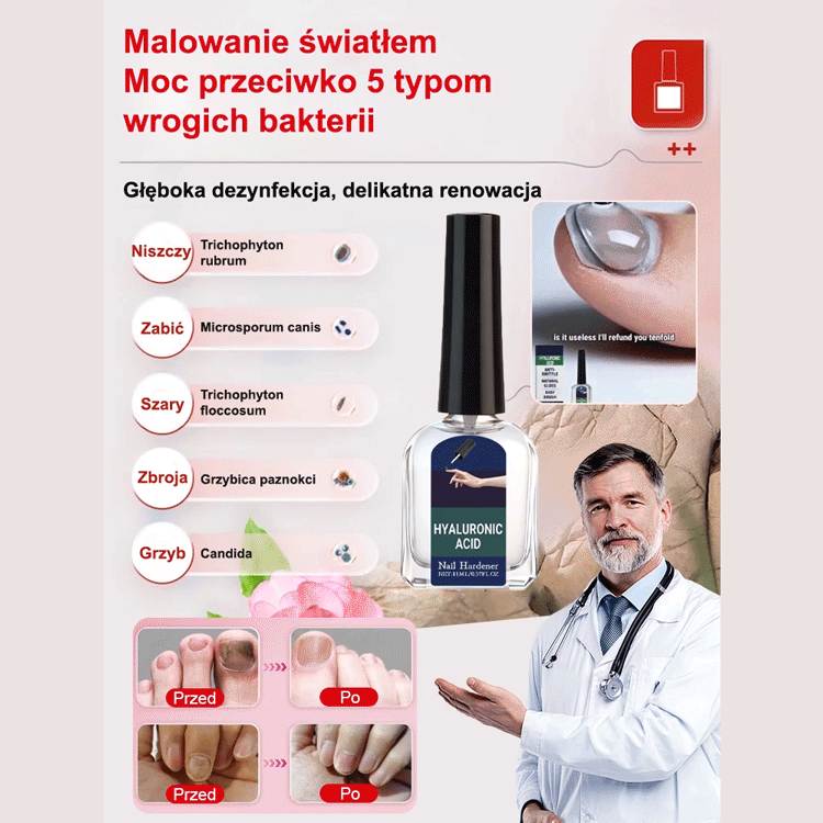 Ziołowe Serum do Regeneracji Paznokci – Skuteczny Preparat na Grzybicę i Odbudowę Płytki (Z Kwasem Hialuronowym)