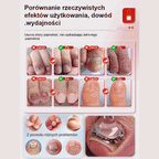 Ziołowe Serum do Regeneracji Paznokci – Skuteczny Preparat na Grzybicę i Odbudowę Płytki (Z Kwasem Hialuronowym)